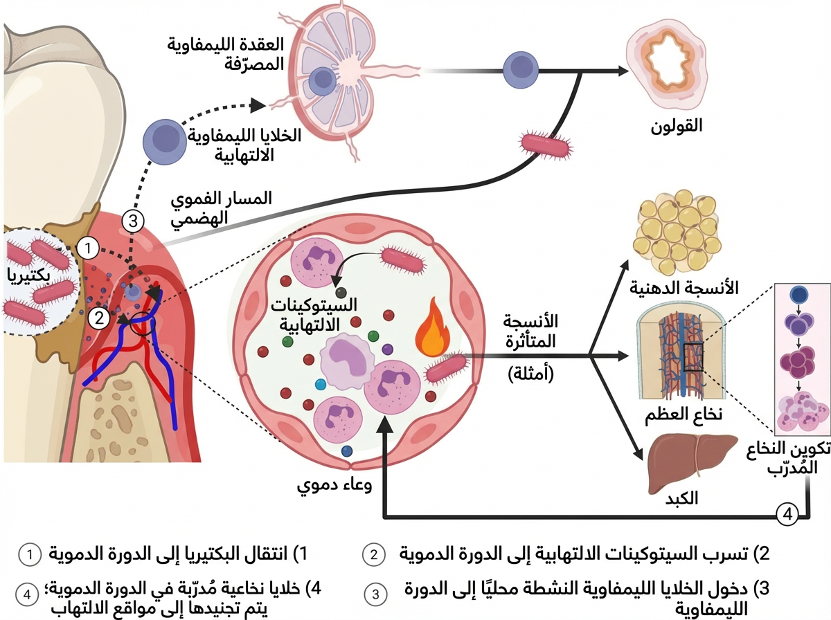 الشكل 3. المسار الذي يربط التهاب دواعم السن بأمراض القلب والأوعية الدموية